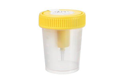 VACUETTE® Urine Beaker with Intergrated Transfer Device, 100ml, yellow cap, sterile (724321) | Urine & Specimen Collection | Bench&Flask